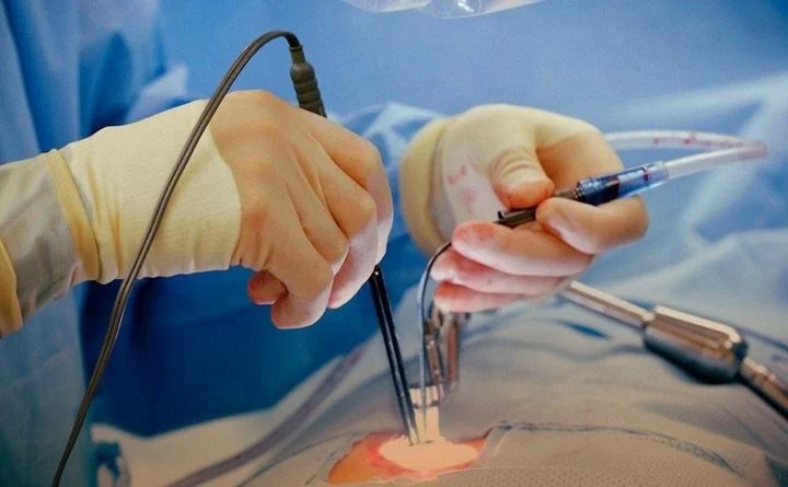 آیا شقاق خطرناک است؟