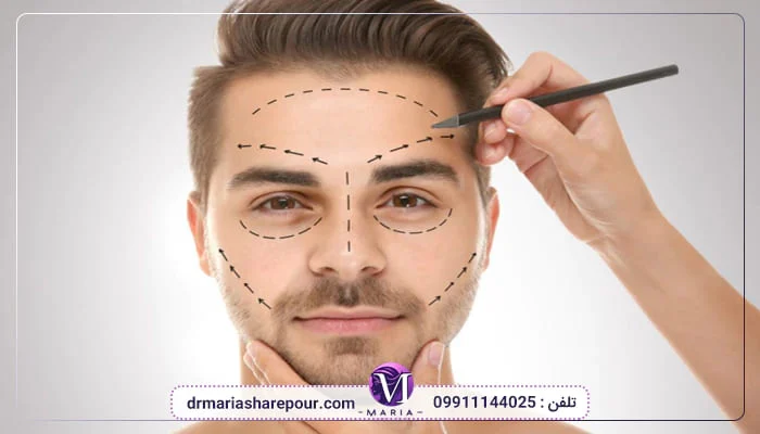 بابل لیفت صورت با فیلر در بابل