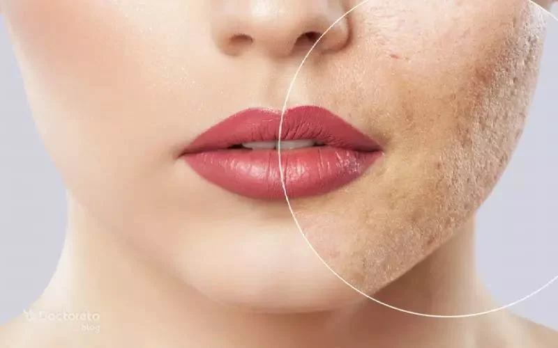 مراقبت صحیح از زخم ها: چگونه مانع ایجاد اسکار شویم؟