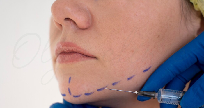 زاویه سازی صورت گرد با ژل