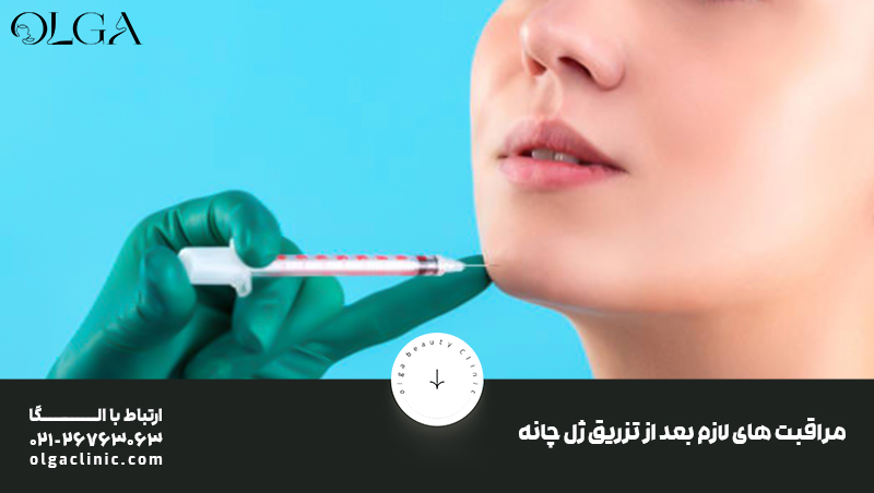 مراقبت های بعد از تزریق ژل چانه 