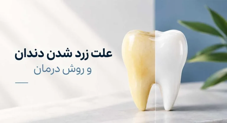 چرا دندان‌ ها زرد می‌ شوند؟  علت زرد شدن دندان و روش درمان