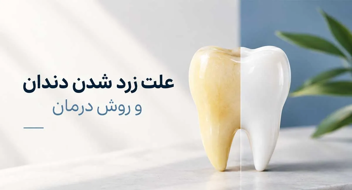 چرا دندان‌ ها زرد می‌ شوند؟ علت زرد شدن دندان و روش درمان